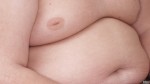 obesos