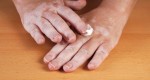vitiligo-pele-tratamento