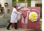 ovarios