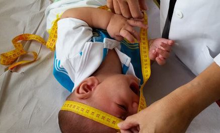 Zika risco de microcefalia em fetos varia entre 1% e 13%, mostra estudo