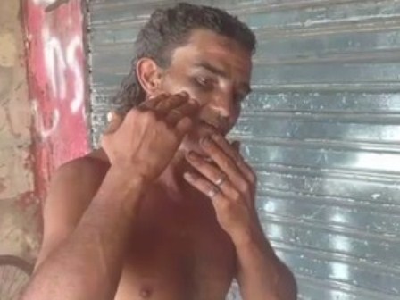 wolverine_machucado